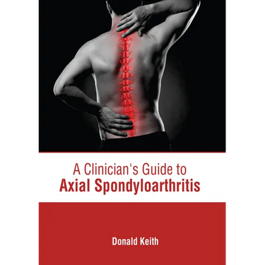 A Clinician's Guide to Axial Spondyloarthritis