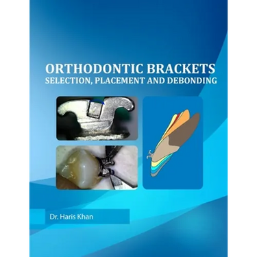 Orthodontic Brackets: Selection, Placement and Debonding