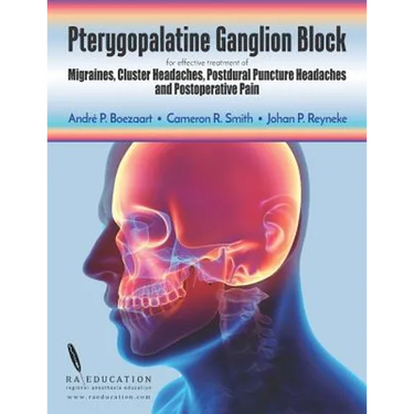 Pterygopalatine Ganglion Block: for effective treatment of Migraine, Cluster Headache, Postdural Puncture Headache & Postoperative Pain