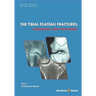 The Tibial Plateau Fractures: Diagnosis and Treatmment