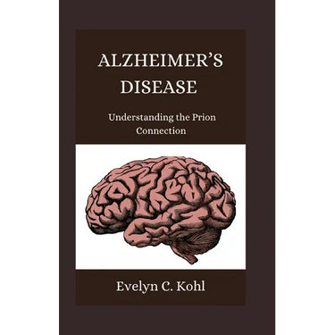 Alzheimer's Disease: Understanding the Prion Connection