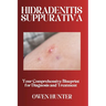 Hidradenitis Suppurativa: Your Comprehensive Blueprint for Diagnosis and Treatment
