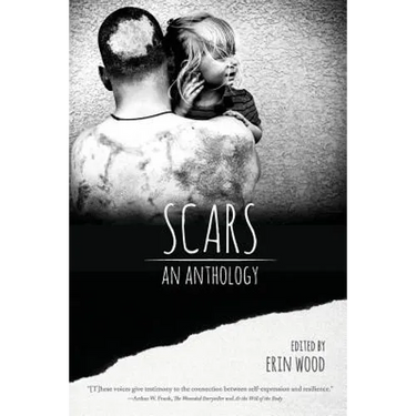 Scars: An Anthology