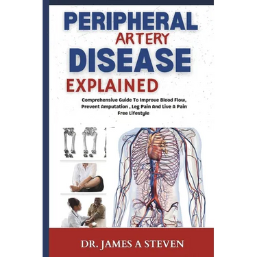peripheral Artery Disease Explained: Comprehensive Guide To Improve Blood Flow, Prevent Amputation, Leg Pain And Live A Pain Free Lifestyle