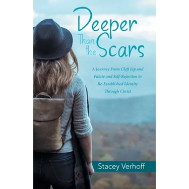 Deeper Than the Scars: A Journey from Cleft Lip and Palate and Self-Rejection to Re-Established Identity Through Christ
