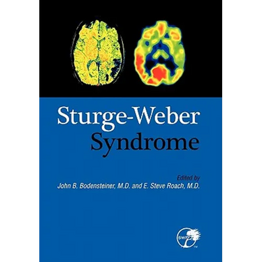 Sturge-Weber Syndrome