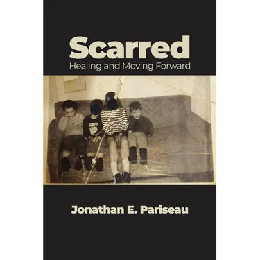 Scarred: Healing and Moving Forward