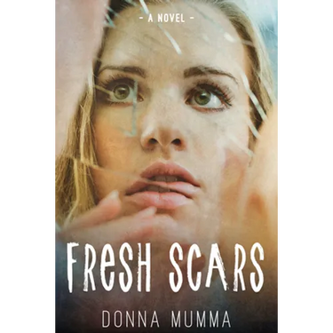 Fresh Scars