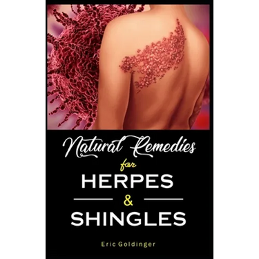 Natural Remedies For HERPES & SHINGLES: The Complete Guide