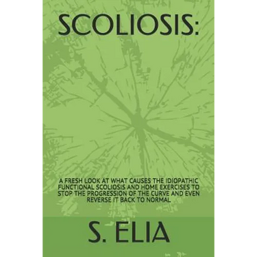 Scoliosis: : A Fresh Look at What Causes the Idiopathic Functional Scoliosis and Home Exercises to Stop the Progression of the Cu