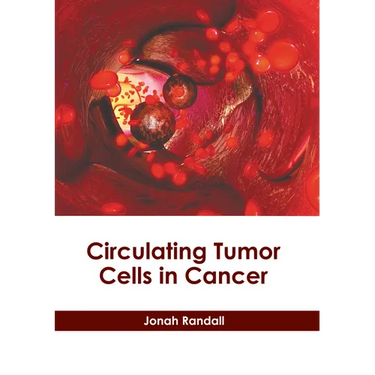 Circulating Tumor Cells in Cancer