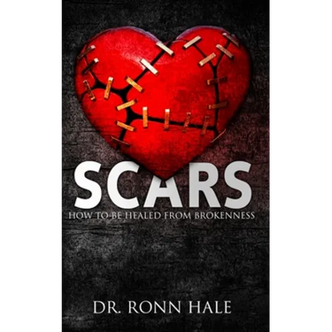 Scars: How to Be Healed from Brokenness