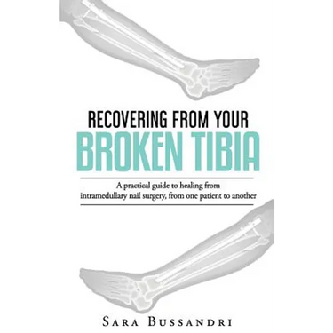 Recovering from your broken tibia: A practical guide to healing from intramedullary nail surgery, from one patient to another