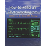 How to Read an Electrocardiogram.