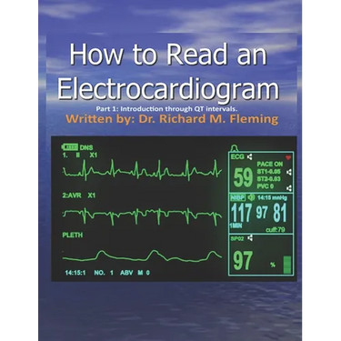 How to Read an Electrocardiogram.
