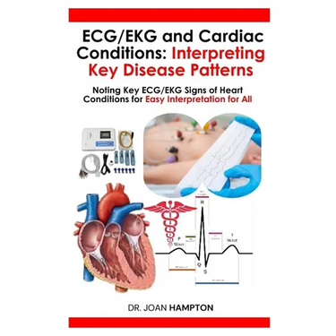 ECG/EKG and Cardiac Conditions: Interpreting Key Disease Patterns: Noting Key ECG/EKG Signs of Heart Conditions for Easy Interpretation for All