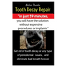 Tooth Decay Repair, dental care, swollen gums, bad breath, dental plaque, dental caries, gum disease, teeth whitening, dental pain, Heal gum teeth, Mo
