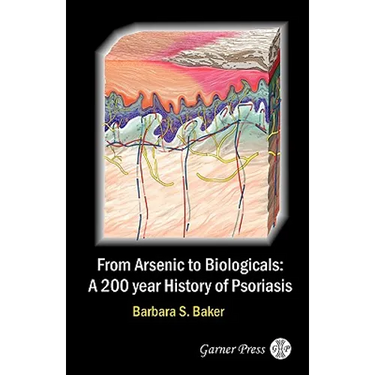 From Arsenic to Biologicals: A 200 Year History of Psoriasis