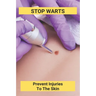Stop Warts: Prevent Injuries To The Skin: Warts Treatment Near Me