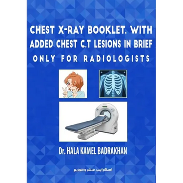 Chest X-Ray Booklet, with added Chest C.T Lesions in brief Only for Radiologists