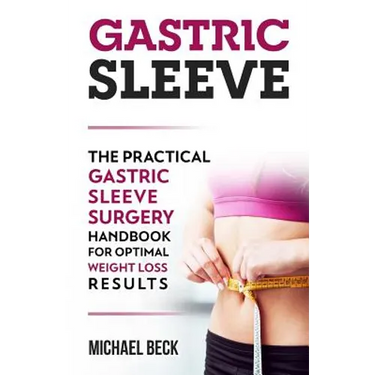 Gastric Sleeve: The Practical Gastric Sleeve Surgery Handbook for Optimal Weight Loss Results