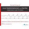 Essential Concepts of Electrophysiology and Pacing Through Case Studies