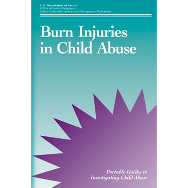 Burn Injuries in Child Abuse