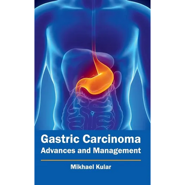 Gastric Carcinoma: Advances and Management