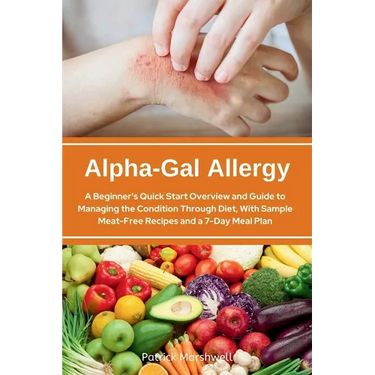 Alpha-Gal Allergy: A Beginner's Quick Start Overview and Guide to Managing the Condition Through Diet, with Sample Meat-Free Recipes and a 7-Day Meal