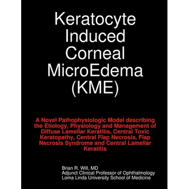 Keratocyte Induced Corneal MicroEdema
