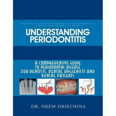 Understanding Periodontitis: A Comprehensive Guide to Periodontal Disease for Dentists, Dental Hygienists and Dental Patients
