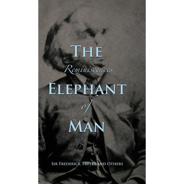 Reminiscences of The Elephant Man