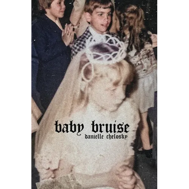 Baby Bruise