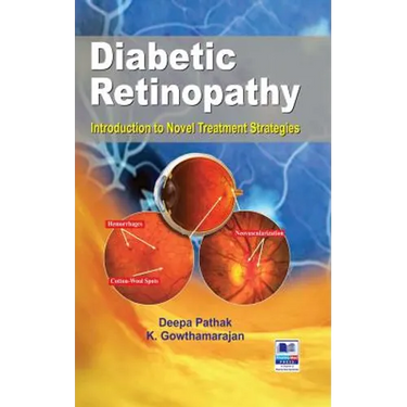 Diabetic Retinopathy: Introduction to Novel Treatment Strategies