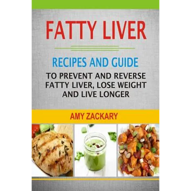 Fatty Liver: Recipes And Guide To Prevent And Reverse Fatty Liver, Lose Weight And Live Longer