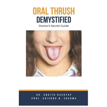 Oral Thrush Demystified: Doctor's Secret Guide