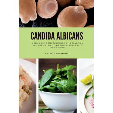 Candida Albicans: A Beginner's 5-Step to Managing the Condition Through Diet and Other Home Remedies, With Sample Recipes