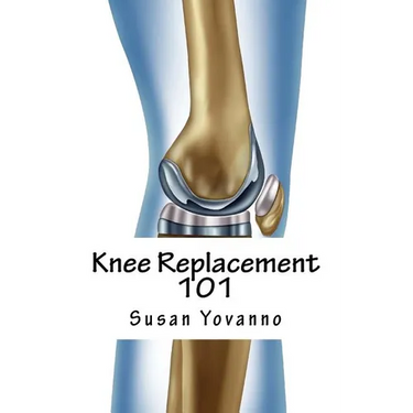 Knee Replacement 101: A User's Guide to Preparation for and Recovery After Knee Arthroplasty