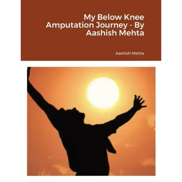 My Below Knee Amputation Journey - By Aashish Mehta