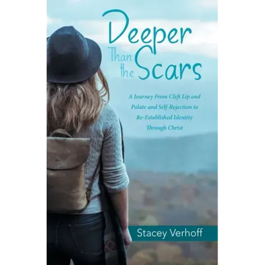 Deeper Than the Scars: A Journey from Cleft Lip and Palate and Self-Rejection to Re-Established Identity Through Christ