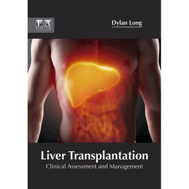 Liver Transplantation: Clinical Assessment and Management