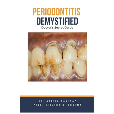 Periodontitis Demystified: Doctor's Secret Guide