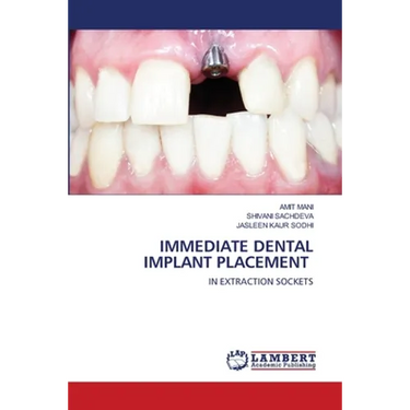 Immediate Dental Implant Placement