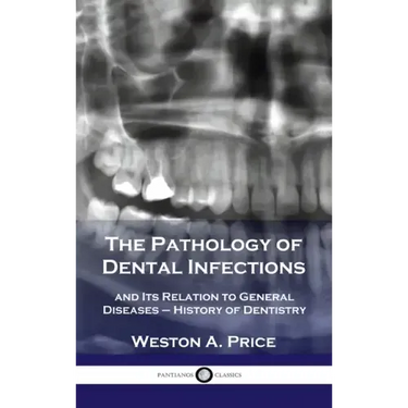 Pathology of Dental Infections: and Its Relation to General Diseases - History of Dentistry