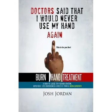 Burn Hand Treatment: A How-To Guide for Rehabilitation with Real Life Experiences from a Burn Survivor