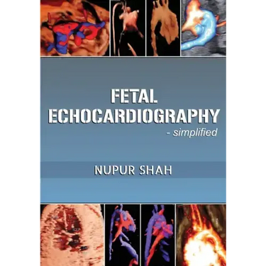 Fetal Echocardiography - Simplified