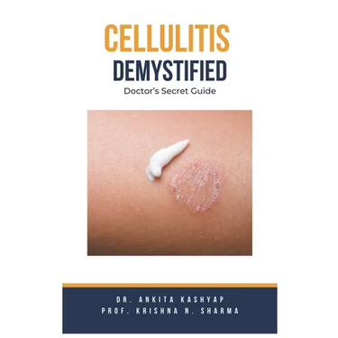 Cellulitis Demystified: Doctor's Secret Guide