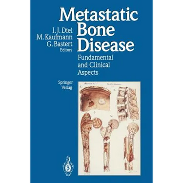 Metastatic Bone Disease: Fundamental and Clinical Aspects