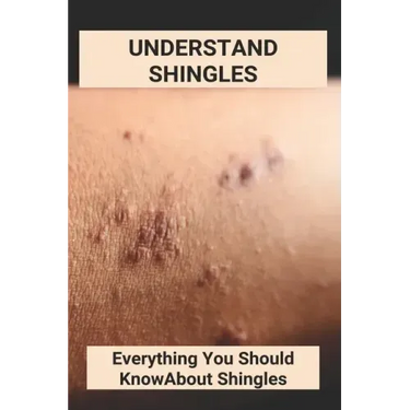 Understand Shingles: Everything You Should Know About Shingles: Shingles Topical Treatment