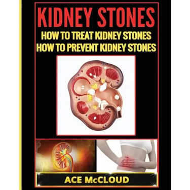 Kidney Stones: How To Treat Kidney Stones: How To Prevent Kidney Stones